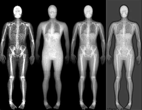 How does a capricorn woman make a cancer man feel. Everything Looks Cooler With X-Rays! | The snow and ice ...