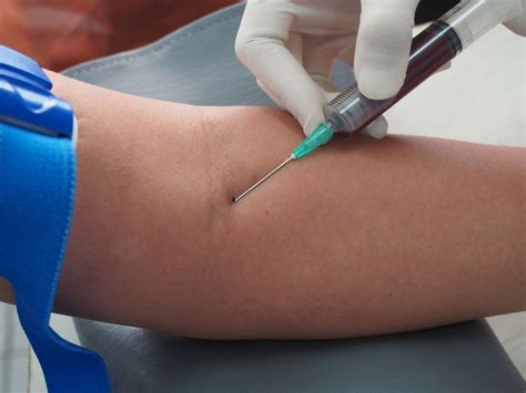 La prise de sang consiste à piquer la peau de façon à recueillir du sang. En Marche - À quoi servent les analyses de sang