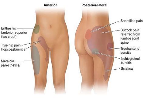 Shoulder joint is the most mobile joint of the human body. Right Side and Hip Pain | Diagram showing various hip pain points by different illnesses ...