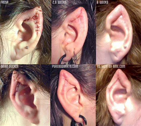 Elf ear surgery is indeed a peculiar way to manifest one's fanaticism to certain fictional characters as the operation could be painful. You Won't Believe These 15 Weird Beauty Trends Have Been ...