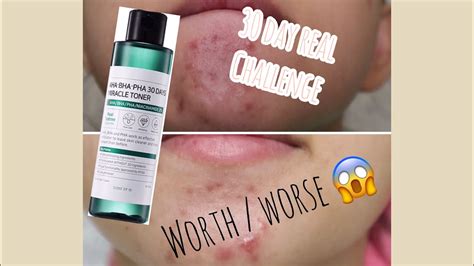 I'd been contemplating the past weeks whether i should purchase the pyunkang yul toner or soon jung toner, and i ended. 30 DAY MIRACLE TONER REVIEW MALAYSIA | WORTH OR WORSE ...