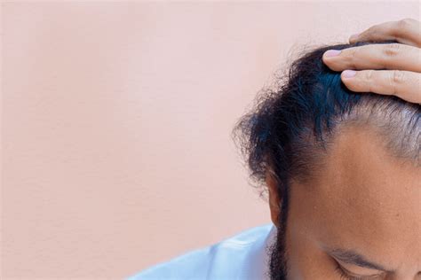 B12 deficiency is also commonly linked to people with stomach or digestive problems. Can Brushing Too Often Cause Hair Loss? » esteGrande Hair ...