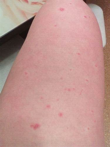 Похудеть в ногах и бедрах фото