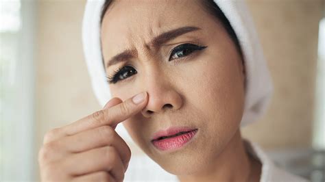 Hindari penggunaan sabun cuci muka mengandung bahan. 5 Cara Ampuh Menghilangkan Komedo Hitam di Hidung ...