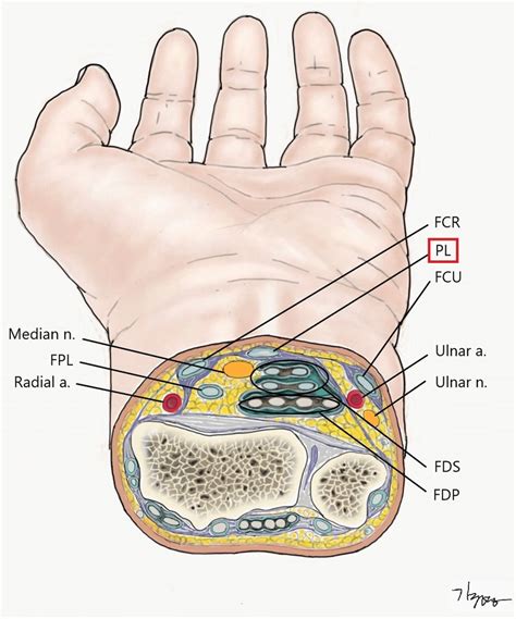 Maybe you would like to learn more about one of these? Tendon Diagram Of Wrist / Common Hand And Wrist Conditions Boston Orthopaedic Spine : Flexion ...