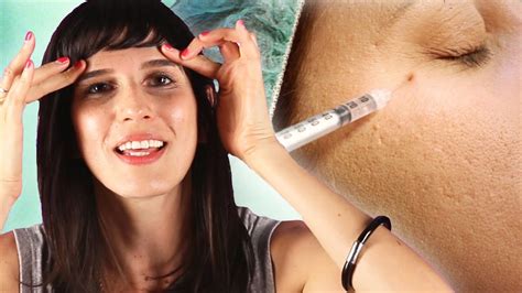 I recommend that my patients come back every 3.5 months so that they have their next injection before the previous botox has completely worn off. Should I Get Botox? - YouTube