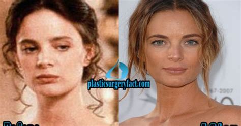 Gabrielle Anwar Plastic Surgery Before and After | http ...