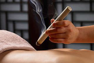 Check spelling or type a new query. การรมยา (Moxibustion) | คณะแพทยศาสตร์โรงพยาบาลรามาธิบดี ...