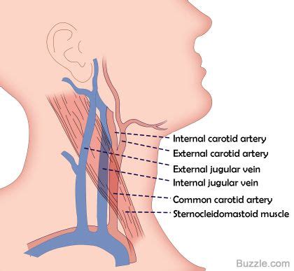 When a clot in the neck stops the flow of blood to the brain, brain cells begin to die. Are the jugular vein and carotid artery present on both ...