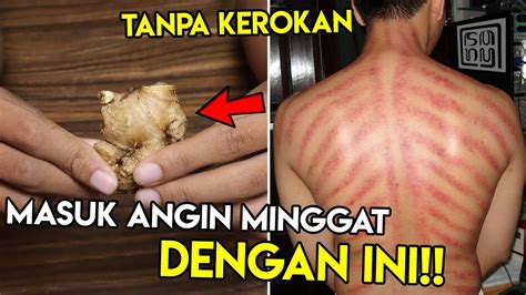 Cara membuat orang mau menjadi ketua rt / ketua rw. Cara Sembuhkan Masuk Angin - YouTube