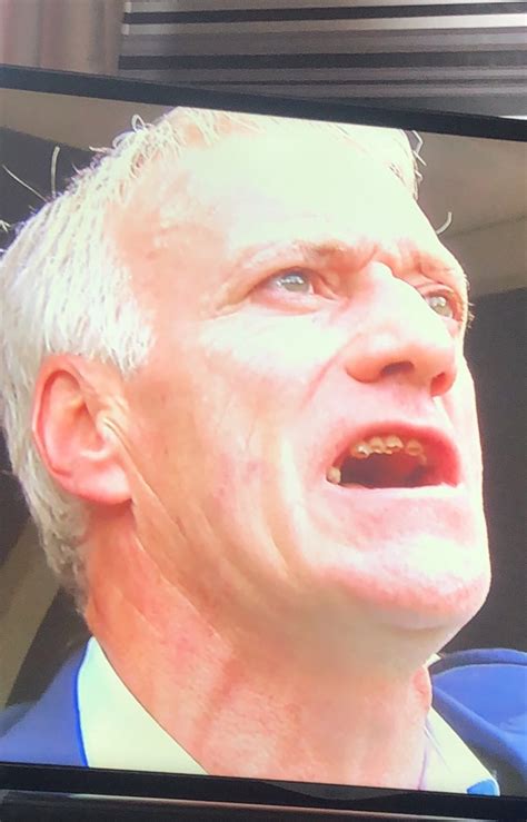 They are usually so measured, precise, a cut above. Didier Deschamps Teeth / Liam Jones On Twitter Didier ...