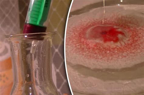 Just apply a small amount of hydrogen peroxide directly to the stain and watch as the red blood stain disappears. Blood and household chemical hydrogen peroxide react in ...