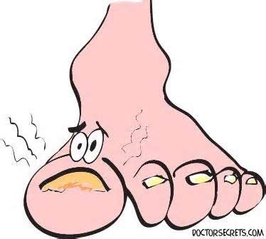 How do i know if i have toenail fungus. How do I know if I have Nail Fungus? | Family Foot & Ankle ...