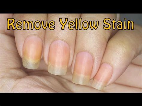 Here's a quick diy tip on how to get that dried up white nail polish out of your leather. How to Remove Yellow Stain on Nails! - YouTube