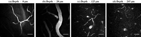 The new study shows, however. In vivo fluorescence imaging of blood vessels in a mouse brain labeled... | Download Scientific ...