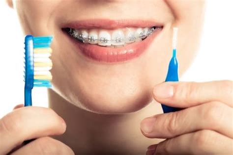 Learn more about proper brace care and how to brush your teeth from tender smiles 4 kids. How to Brush Your Teeth with Braces - Playa Vista Orthodontics