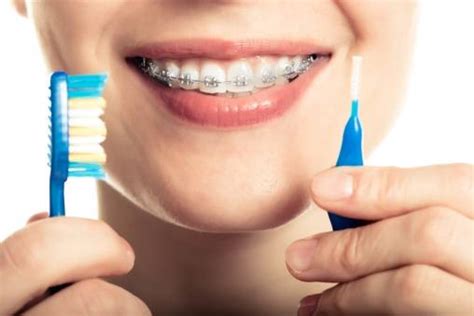 Orthodontic appliances make it more difficult to clean your teeth, as plaque builds up quickly around holders, braces and wires. How to Brush Your Teeth with Braces - Playa Vista Orthodontics