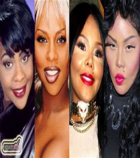 20 Of The Worst Celebrity Plastic Surgery Disasters