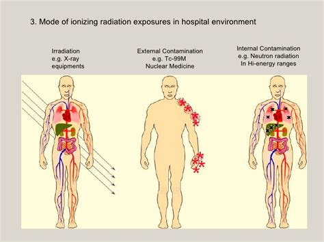 Peritoneal mesothelioma is a cancer in the lining of the abdomen. mesothelioma treatment - wikitechy