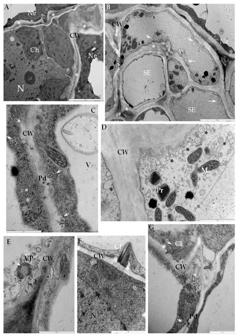 Our results suggest that the cortical vrc serves not only as the replication factory of viral rna but also as a transportation hub, which transports viral rna to neighboring uninfected cells via. IJMS | Free Full-Text | Plant Cell Wall Dynamics in ...