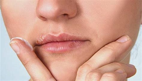 It appears in the form of sores on the mouth or genitals. 15 Most Common Skin Rashes | New Life Ticket - Part 15