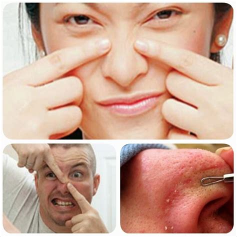 Jadi, apakah rutin yang korang boleh buat untuk hilangkan masalah whitehead dan blackhead ini? Hilangkan blackhead & whiteheads serta jadikan kulit muka ...