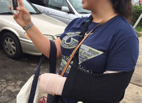 So, how do you know if you've sprained your wrist versus broken it? How To Break Your Wrist