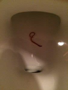 Worms appear in the toilet. Worm in Unused Toilet Likely an Earthworm - All About Worms