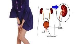 Bakteri yang paling sering menyebabkan cystitis adalah bakteri normal yang sebenarnya ada di usus. Obat Tradisional Untuk Infeksi Saluran Kencing | Obat ...