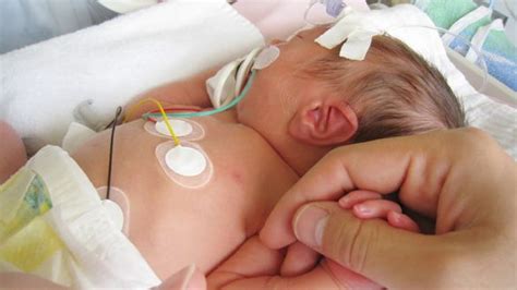 Gambar baby comel pasti sahaja membuatkan kita tersenyum disebabkan oleh reaksi atau telatah yang terakam dalam gambar tersebut. Cara Merawat Tali Pusar Bayi Setelah Puput - Berbagi Rawat