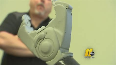 Complete the survey at the top of the page. Wake Forest man receives bionic hand - ABC11 Raleigh-Durham