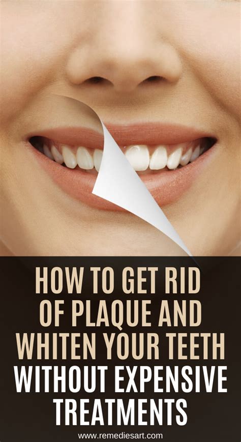 The band exerts pressure that draws the teeth together, consequently closing the gap. Pin on Home Remedies