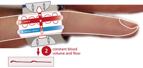 Можливість попереднього запису у чергу та інше. CNAP® Blood Pressure | CNSystems Medizintechnik GmbH