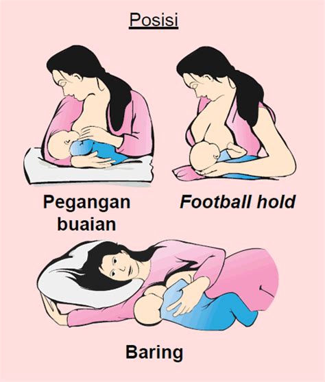 Belakang badan ibu dan kepala disokong dengan bantal dalam keadaan selesa. Penyusuan susu ibu bagi bayi yang menghidap CHD - Positive ...