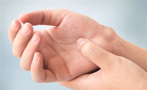 Scientific researches proved that it has antimicrobial properties. Ganglion Cyst Removal - Skin Surgery Clinic