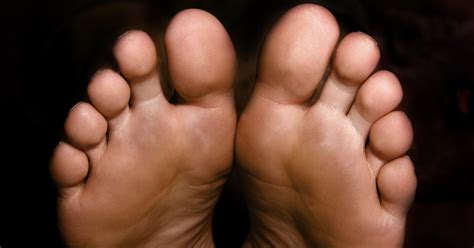 A plantar callus is found on the bottom of the foot. What Are the Causes of Seed Corns? | LIVESTRONG.COM