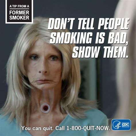 Care guide for lung cancer. Tip from a Former Smoker - Don't tell people smoking is ...