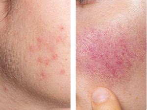 LA SALUTE DELLA PELLE | Logofarma | Dermatologia