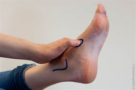 Je zou het ook rustpijn kunnen noemen. Ottawa Ankle Rules - Eerste Hulp Wiki