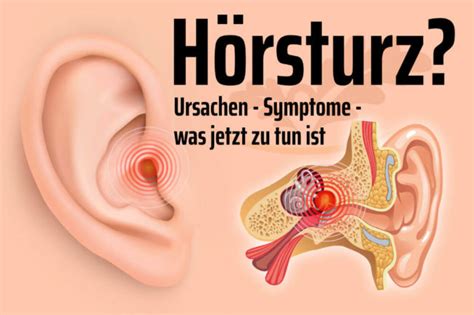Wenn diese aber nicht gut anschlagen oder sie besonders häufig an kopfschmerzen leiden, ist ein arztbesuch empfehlenswert. Hoersturz Ursachen Behandlung Warnsignale Symptome Wann ...