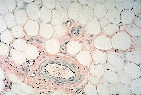 In addition to adipocytes, adipose tissue contains the stromal vascular fraction (svf). ADIPOSE TISSUE -- White Adipose Tissue