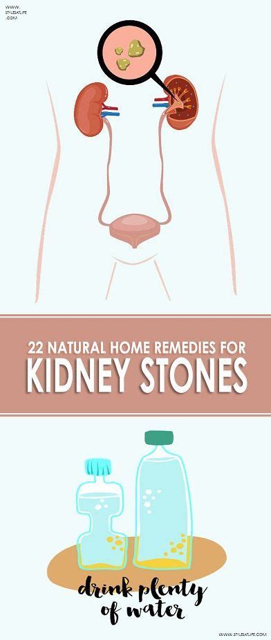 And within a short time, the stone will be decomposed and come out along with the urine. 22 Natural Home Remedies For Kidney Stones. | Kidney ...