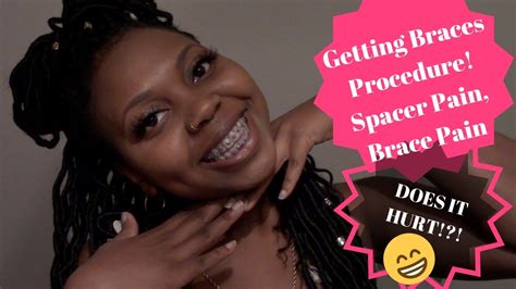 Generally, getting your braces off does not cause pain: Getting Braces on Procedure|Spacer Pain|Brace Pain VLOG ...