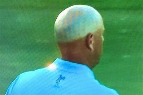 Stewart cink's astonishing cap tan line makes a return at the open stewart cink's astonishing cap tan line makes a return at the. Funny Stuff for Your Day: Freaky - Professional Golfer ...