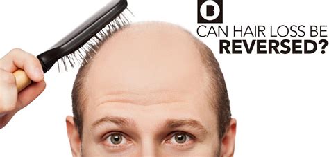 If the cause is treatable, it's likely curable and hair loss can be reversed. Can Hair Loss Be Reversed? - Bamboo AestheticsBamboo ...