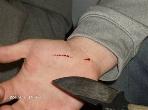 Stab wounds www forensicmed co uk. Knife With Blood Drawing at GetDrawings | Free download