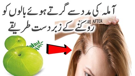 A recent research indicates that every human being daily hair fall around 60 to 100 hair daily, if you notice that this ration is higher than 100 then you need a hair fall tip or totkay. Amla for Hair Growth in urdu | Hair Growth Tips - YouTube