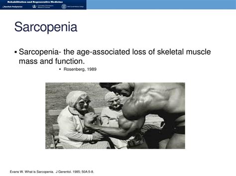 Sarcopenia is a disorder characterized by a loss of muscle mass and muscle strength. PPT - THE postmenopausal Female & the role of exercise ...