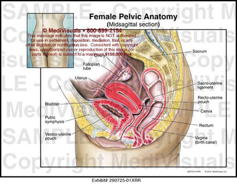 Ischial tuberosities, sacrotuberous and sacrospinous ligaments and, tip of the coccyx. Female Pelvic Anatomy Medical Exhibit Medivisuals