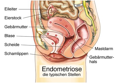 Da der zyklus jedoch bei jeder frau individuell ist, stimmt die faustregel vom eisprung am 14. Eisprung Schmerzen: Hilfe und Ursachen - Heilpraxis